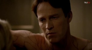 Stephen Moyer stars as Bill Compton, the latest Hep-V victim, from HBO's True Blood Season 7